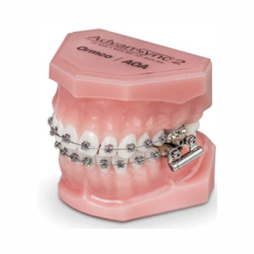 Beugel van Advansync orthodontie in combinatie met een gewone beugel