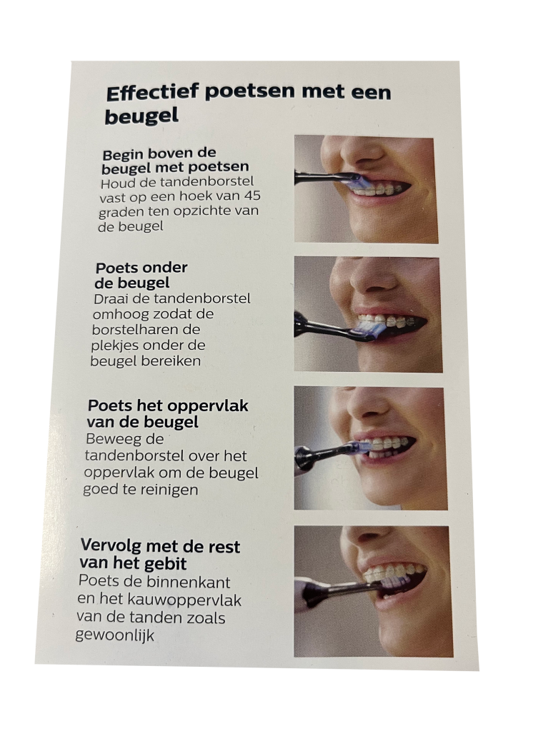 Effectief Poetsen met de beugel